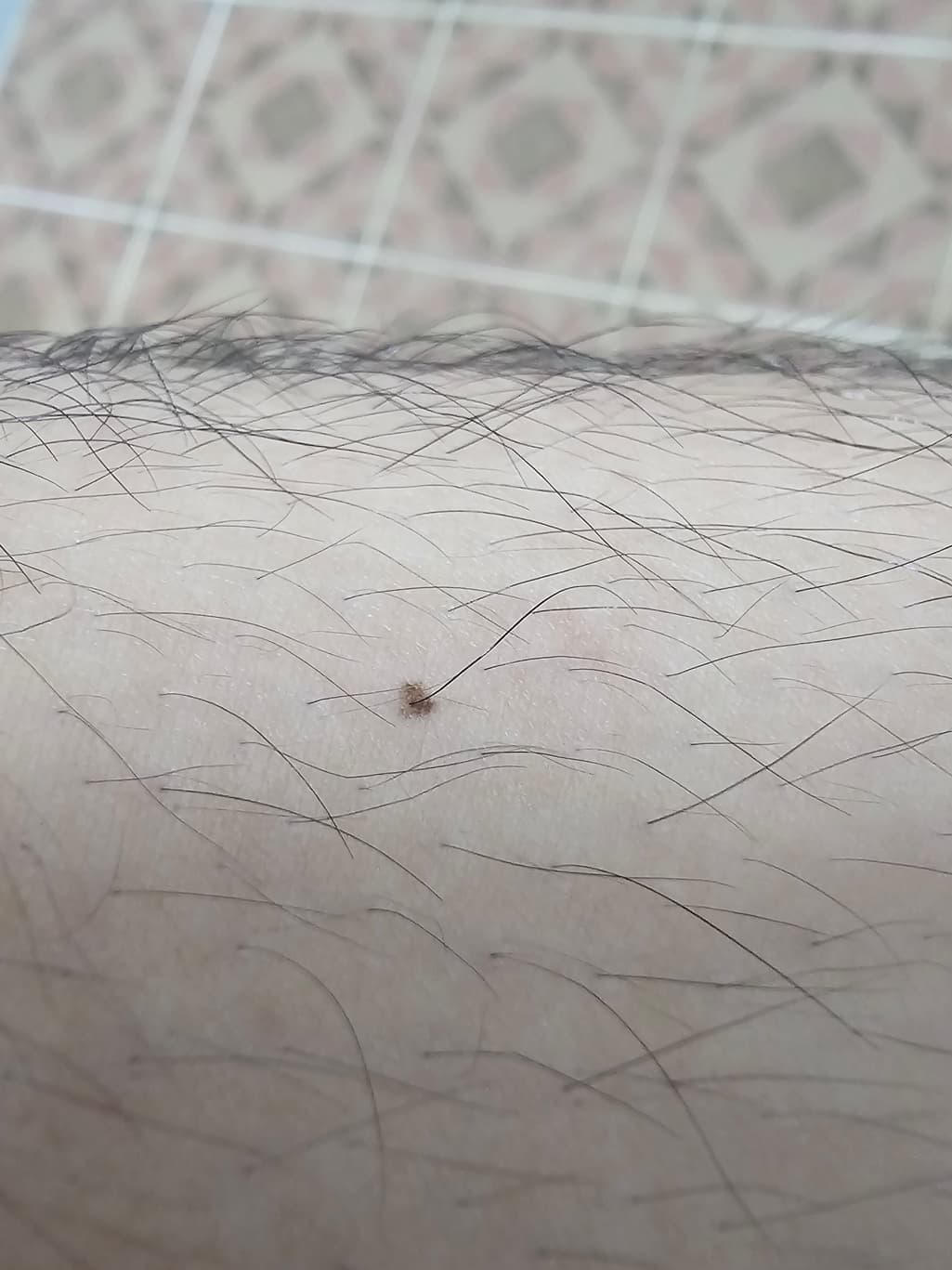 2번 째 사진