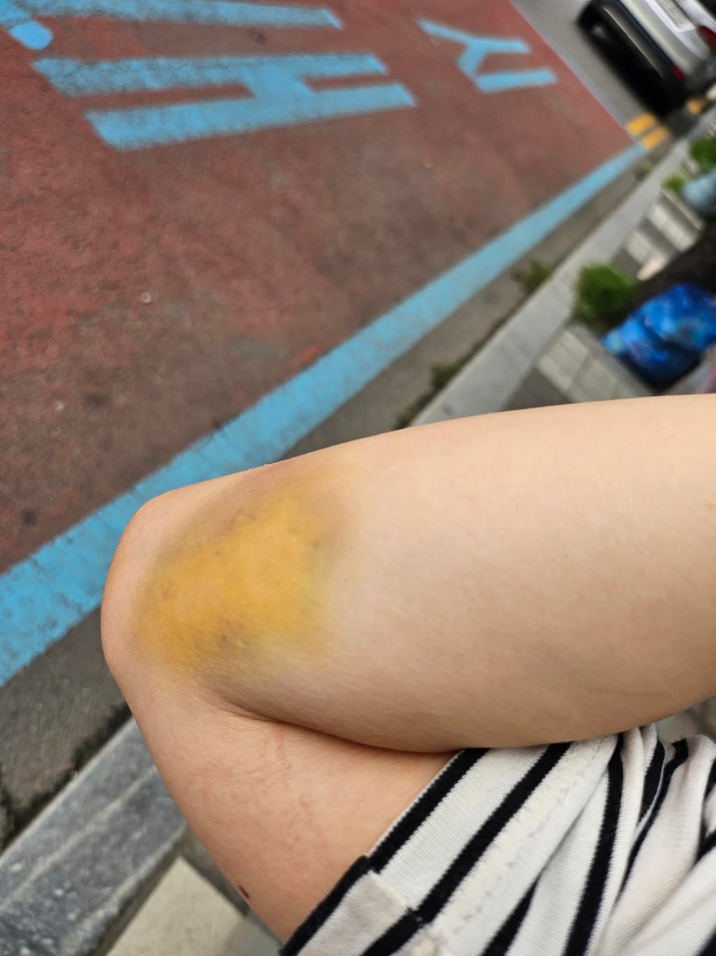 1번 째 사진