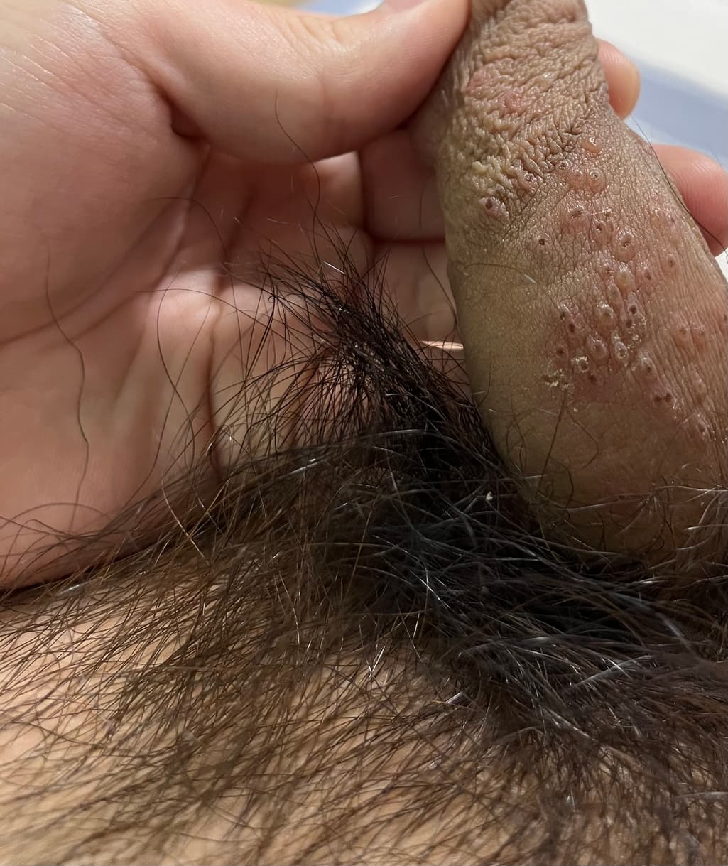 2번 째 사진