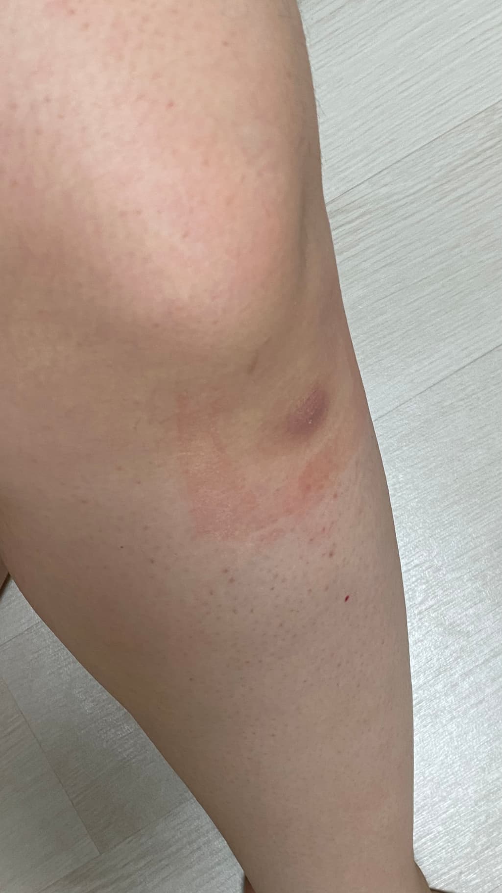 2번 째 사진