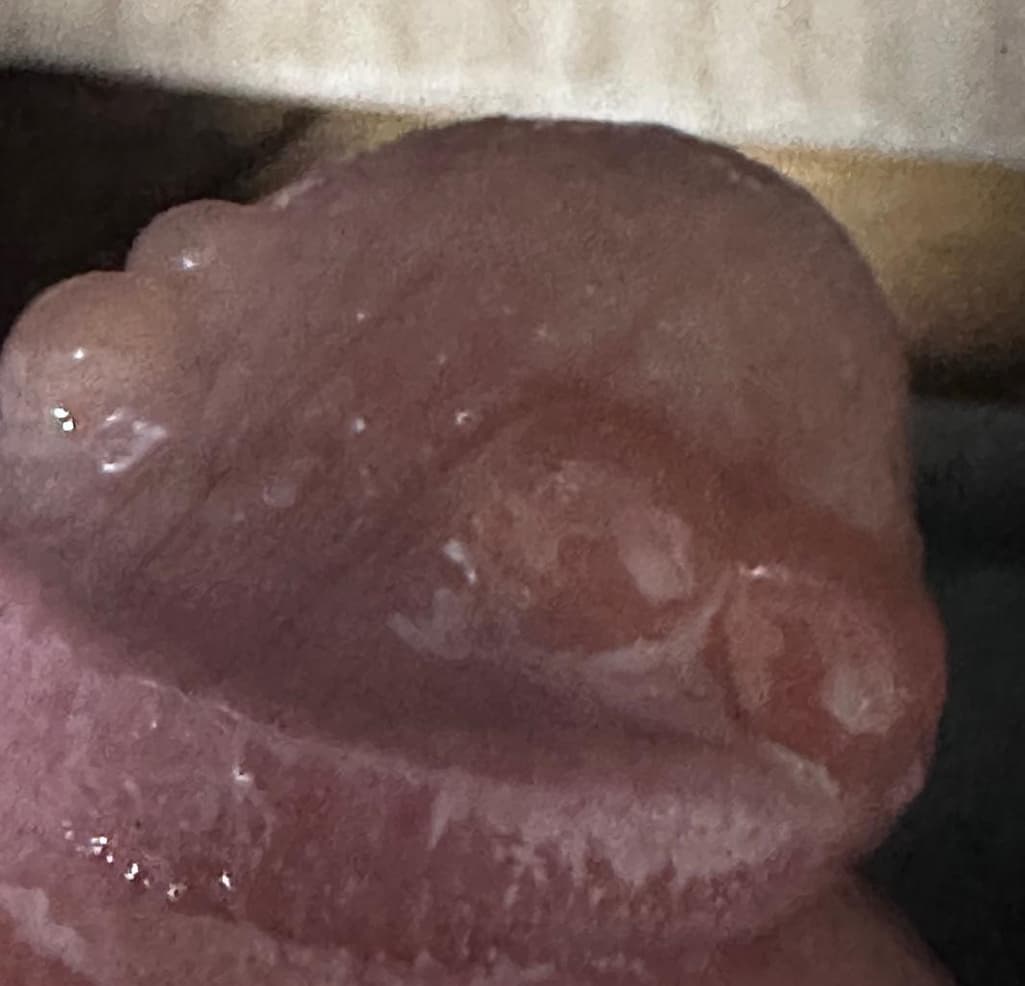 2번 째 사진