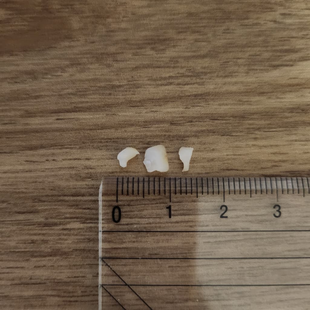 2번 째 사진