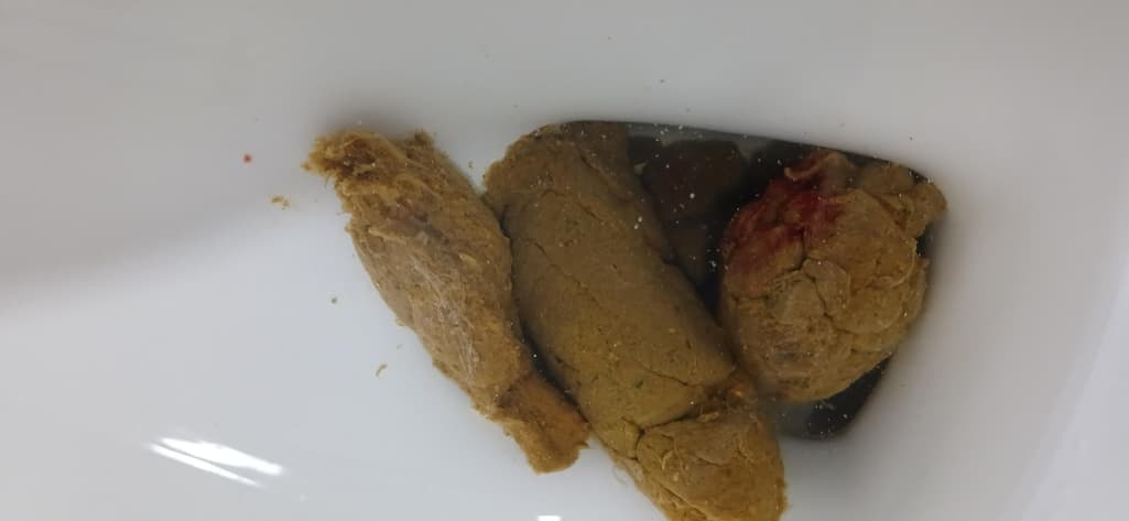 2번 째 사진