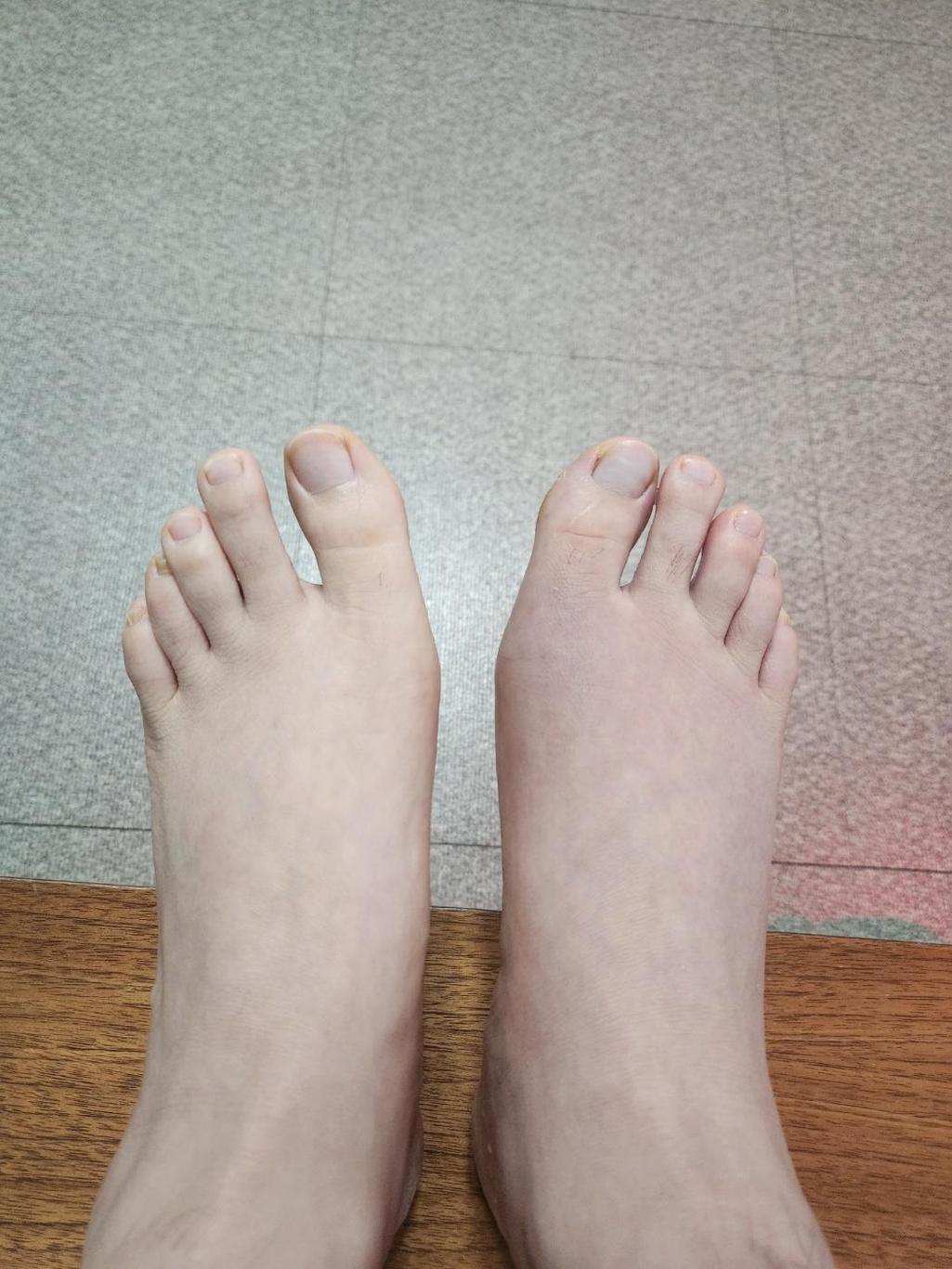 3번 째 사진
