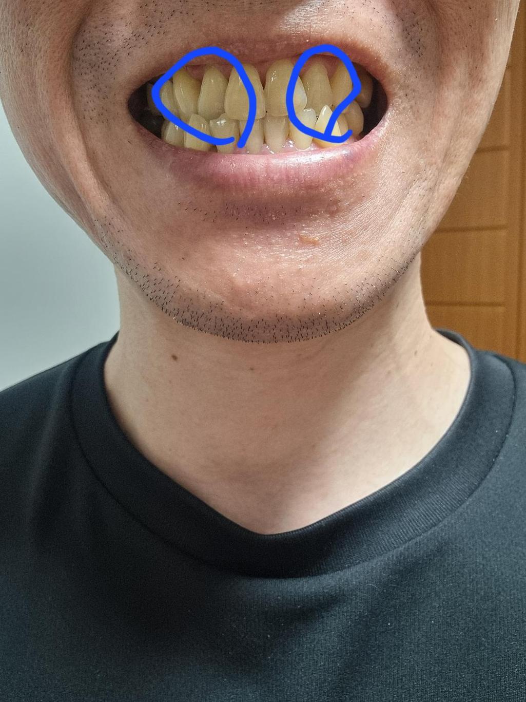 2번 째 사진