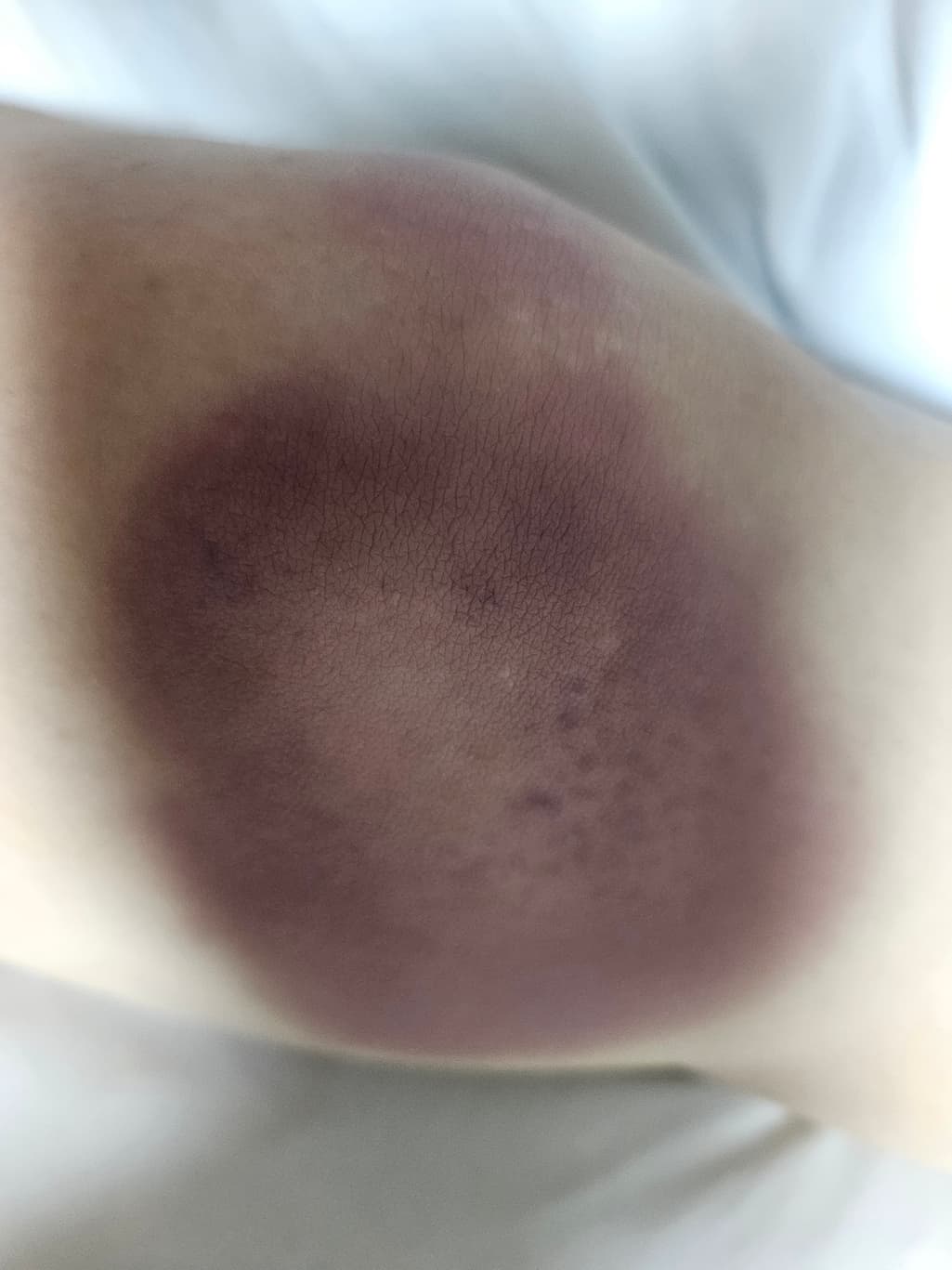 2번 째 사진