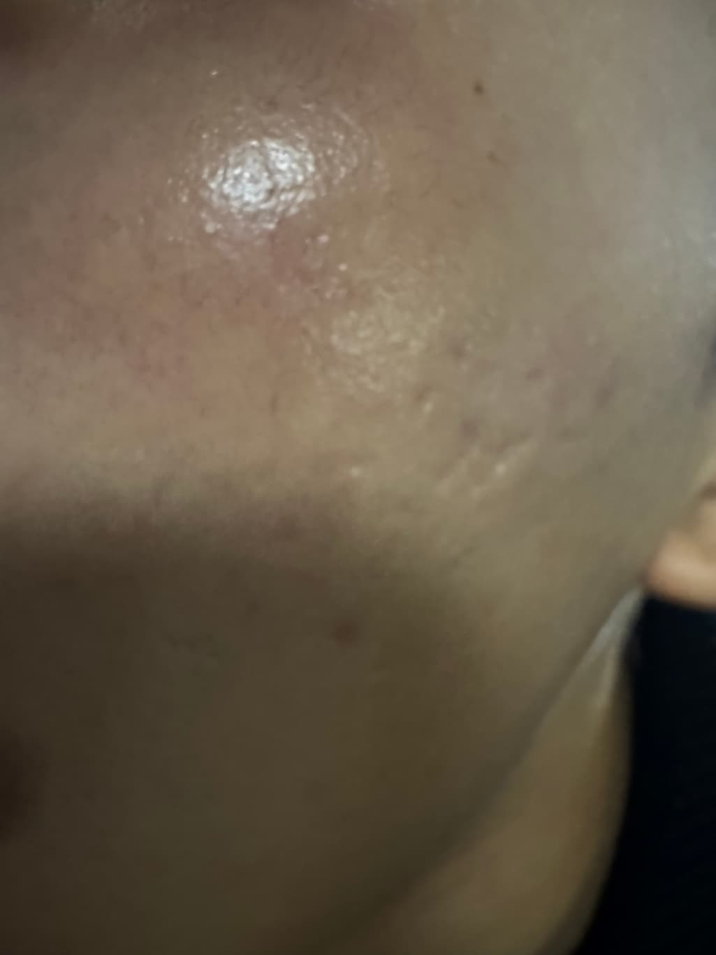 4번 째 사진