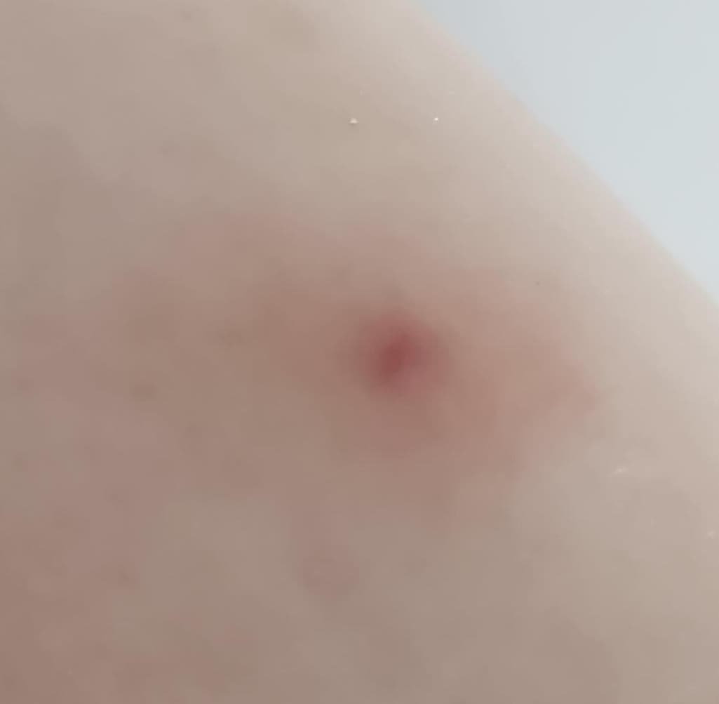 2번 째 사진