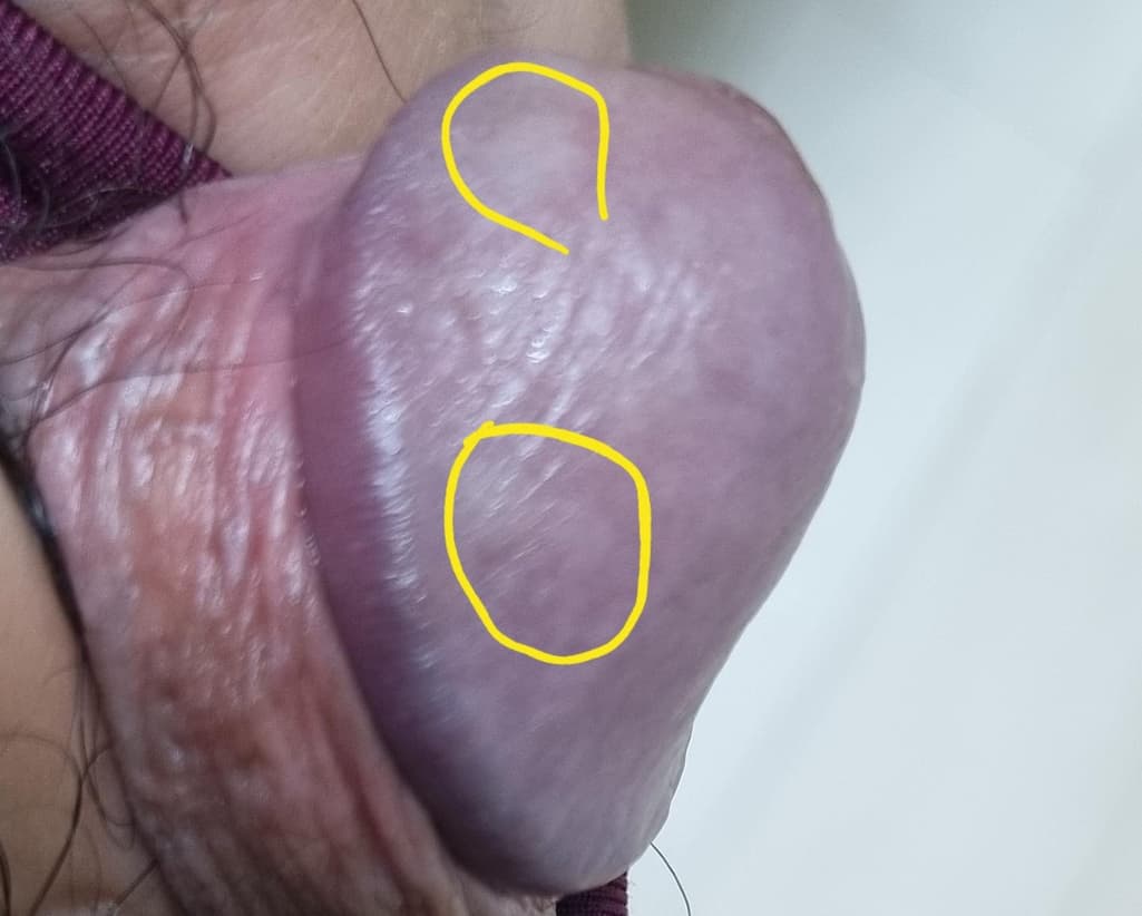 3번 째 사진