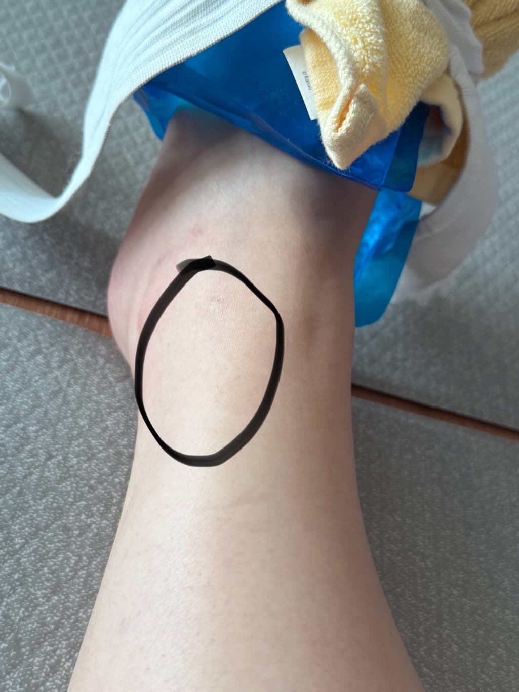 1번 째 사진