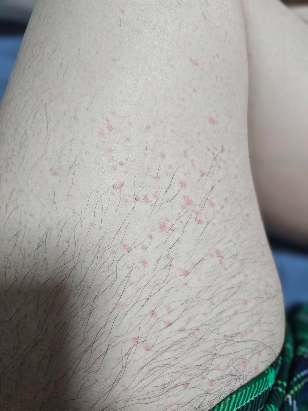 2번 째 사진
