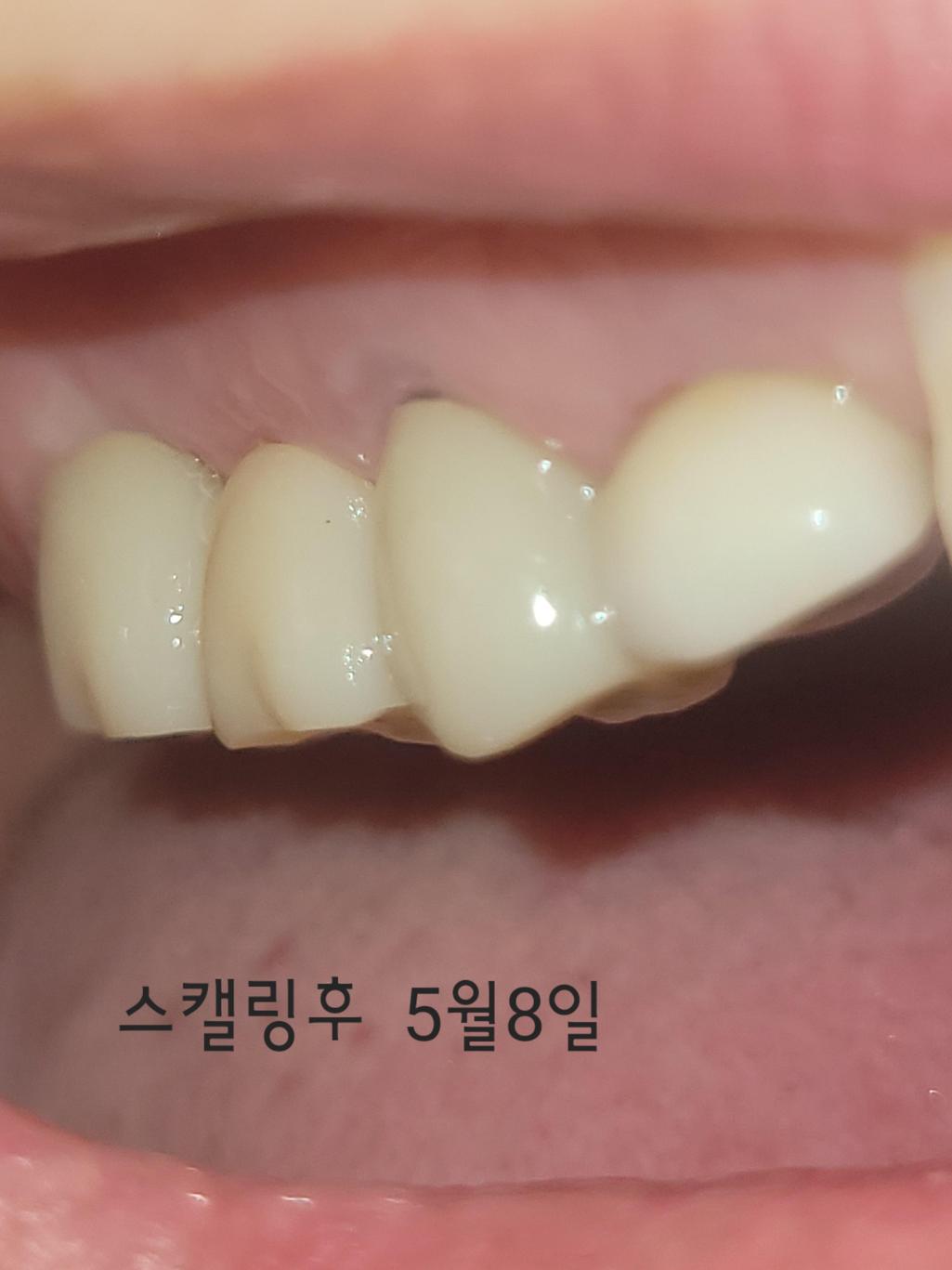 2번 째 사진