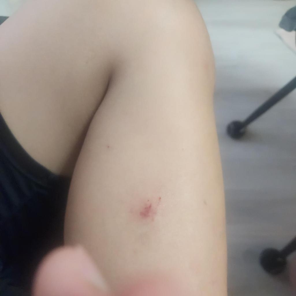 2번 째 사진