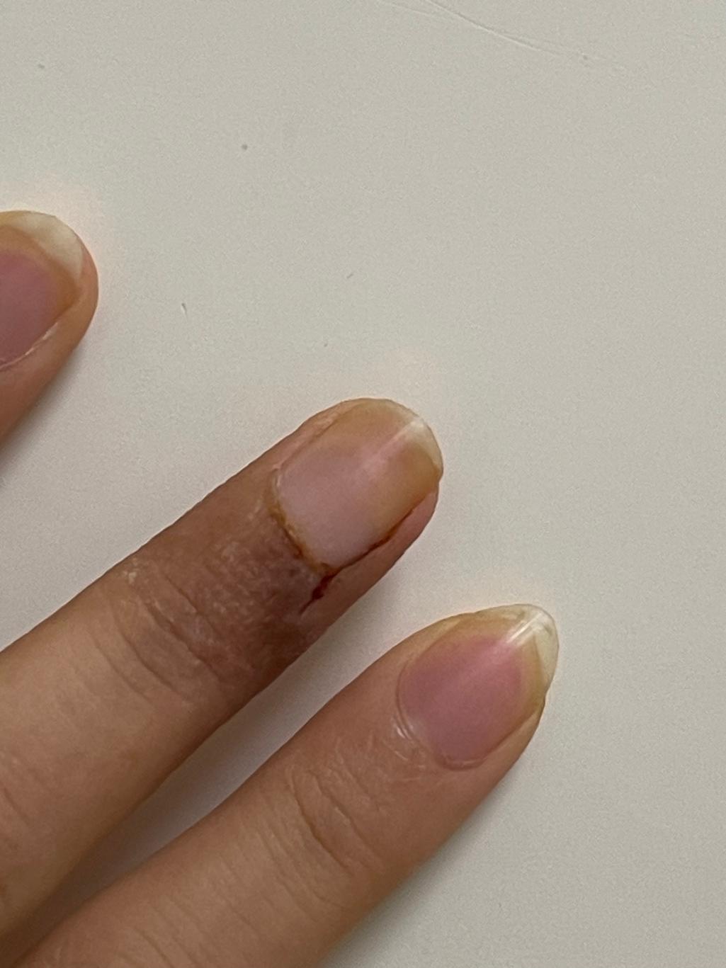 2번 째 사진
