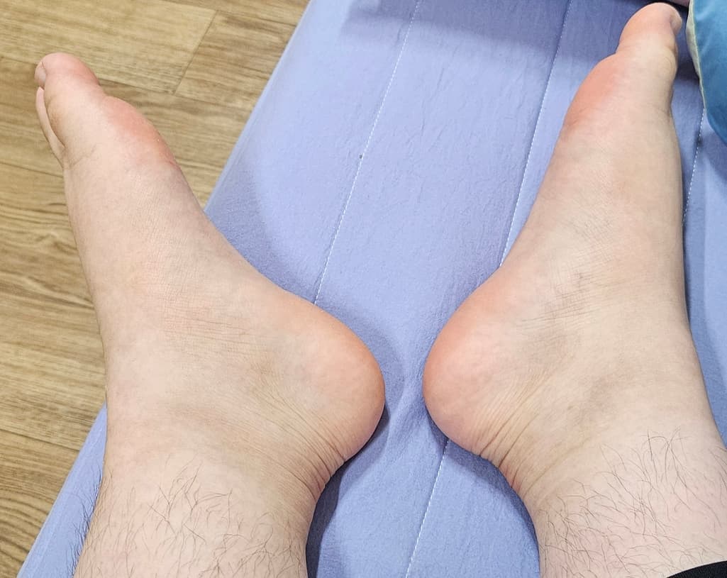 2번 째 사진