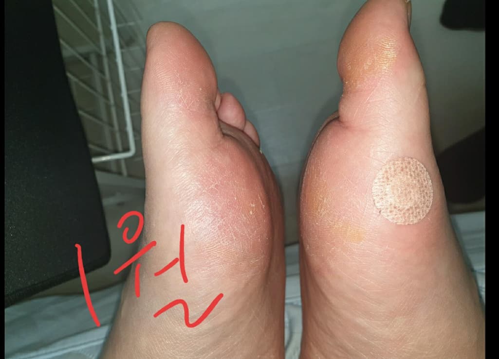2번 째 사진