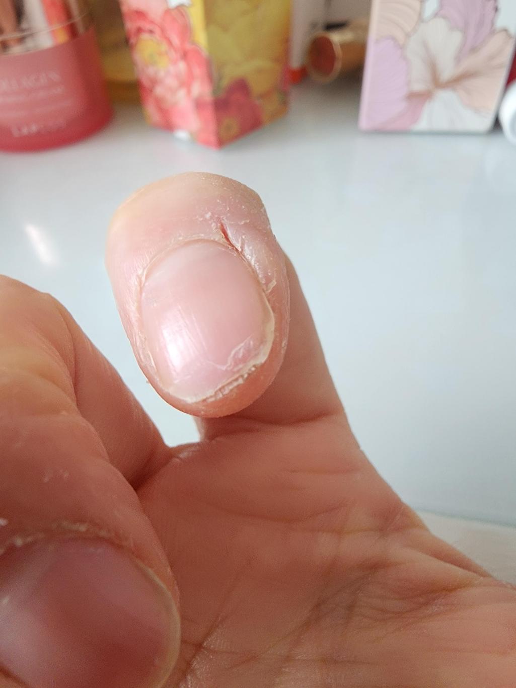 2번 째 사진