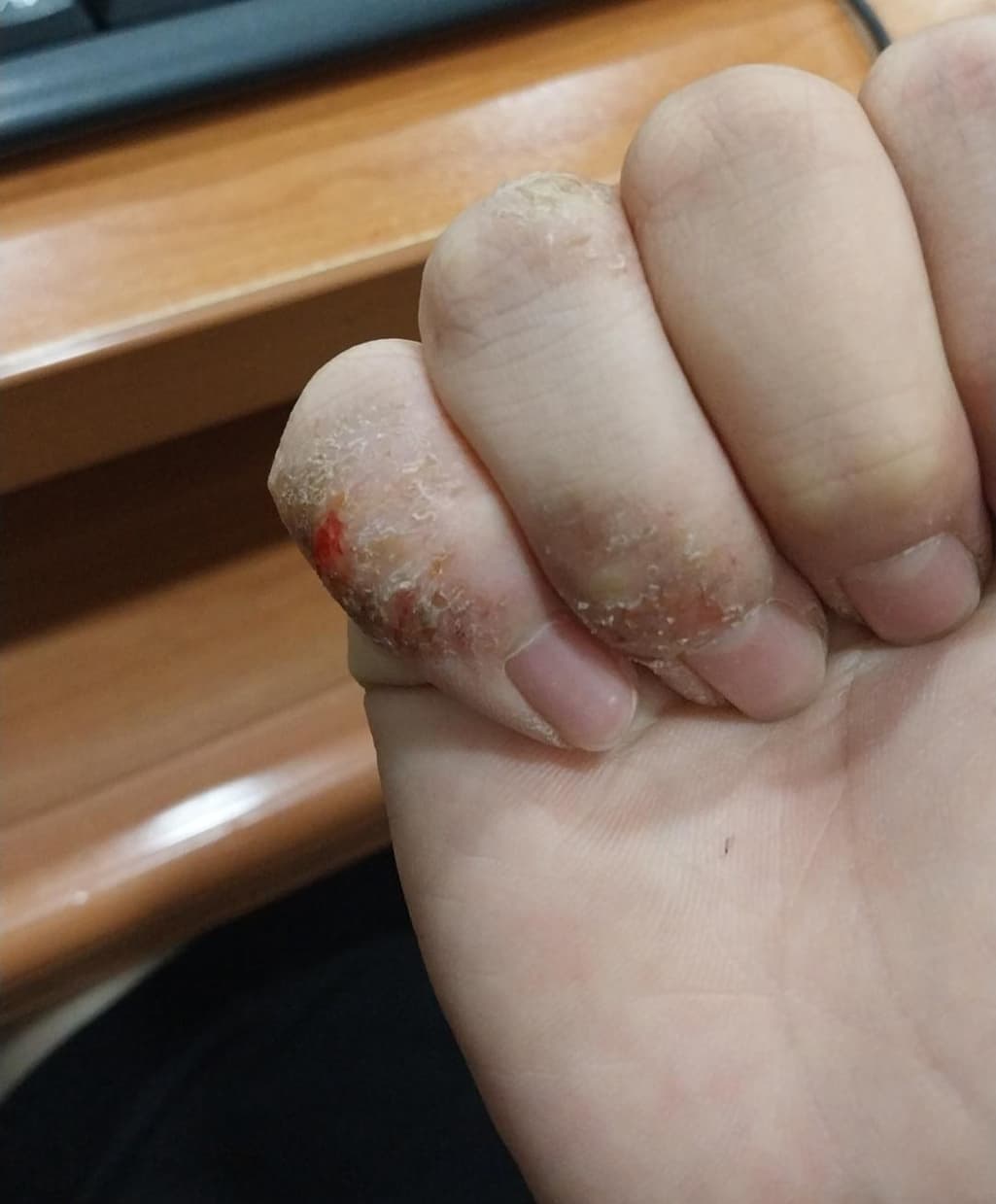 1번 째 사진