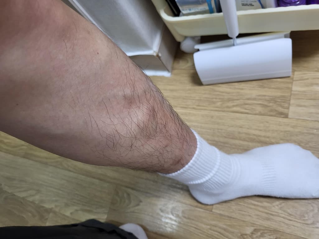 1번 째 사진