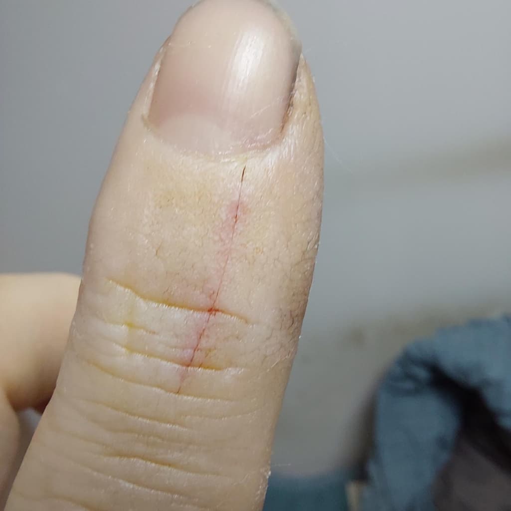 2번 째 사진