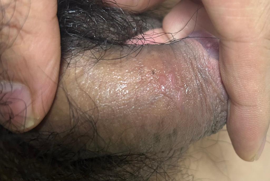 2번 째 사진