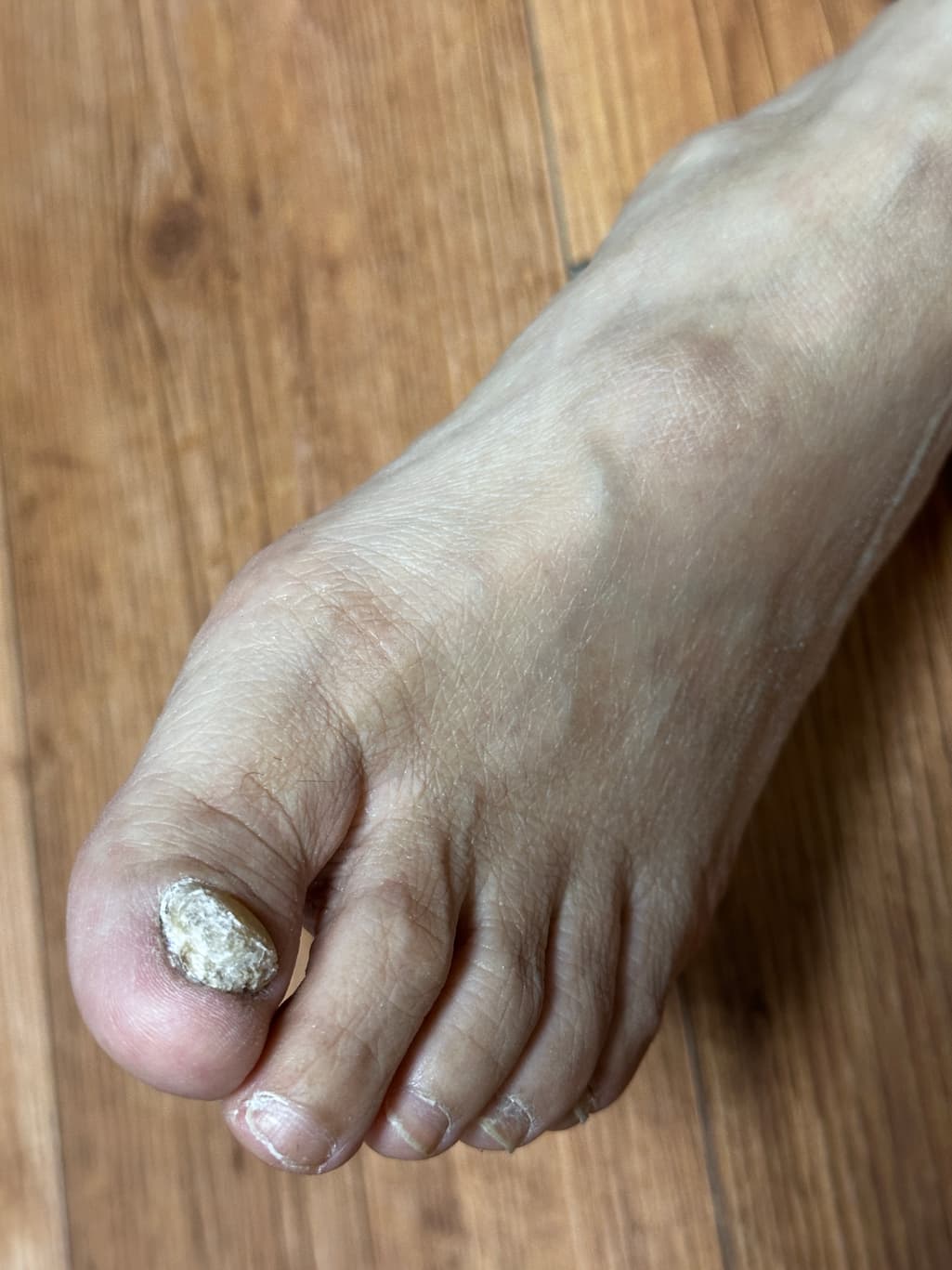 3번 째 사진