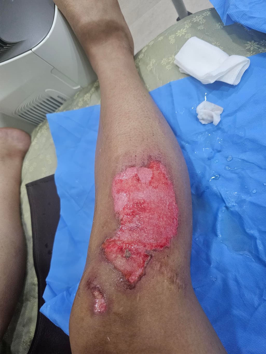 1번 째 사진
