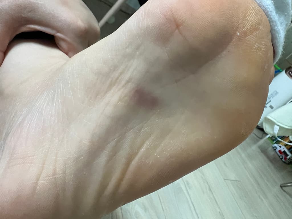 2번 째 사진