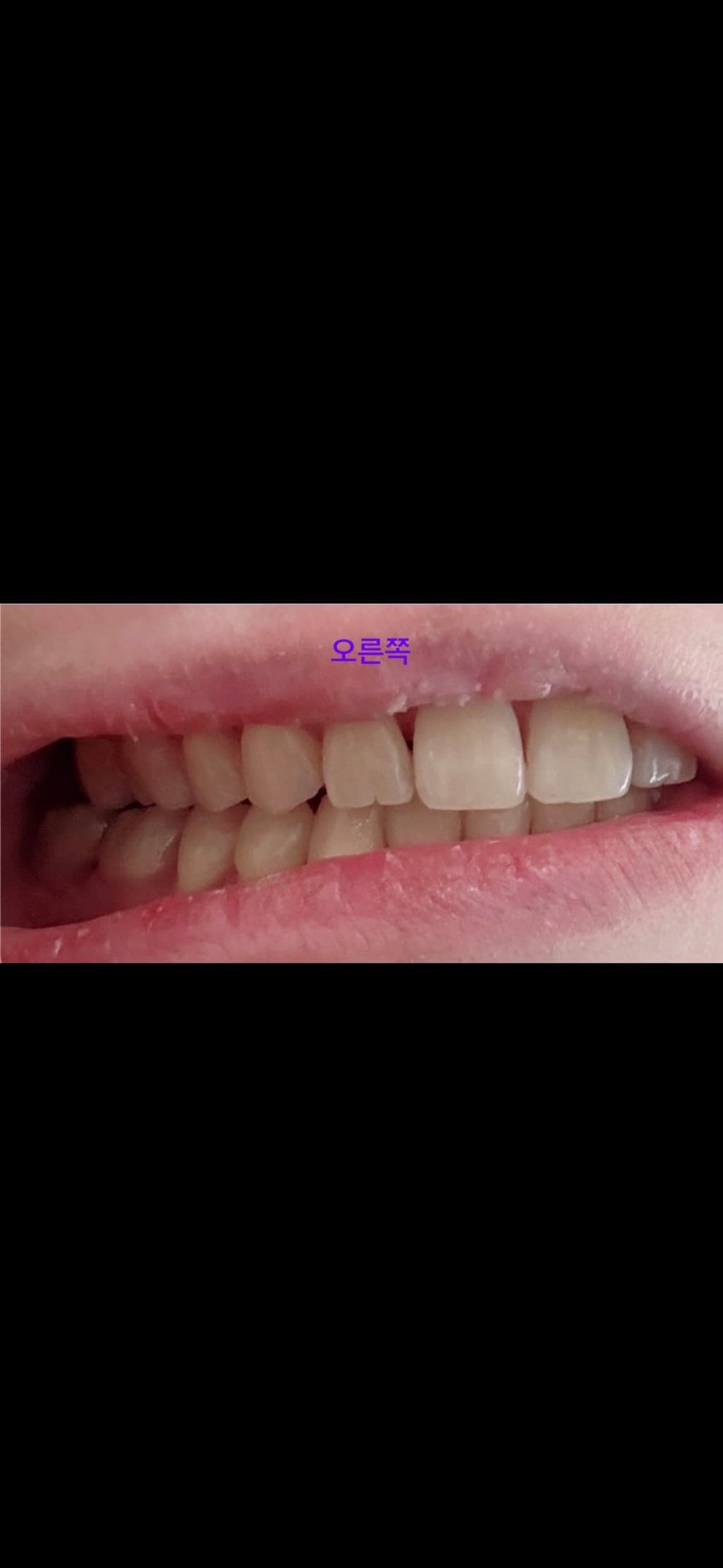 3번 째 사진