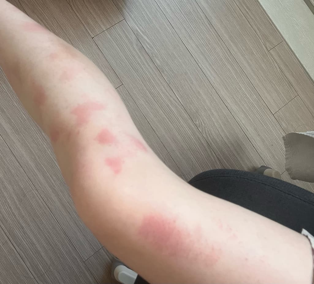 3번 째 사진