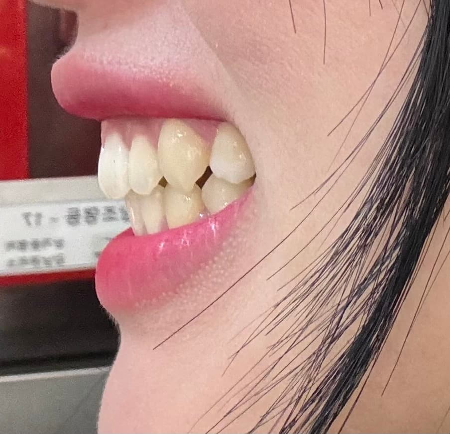 1번 째 사진