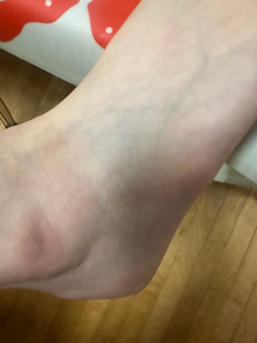 2번 째 사진