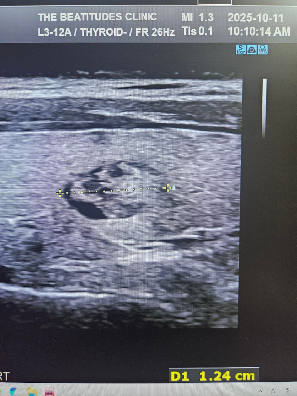 3번 째 사진