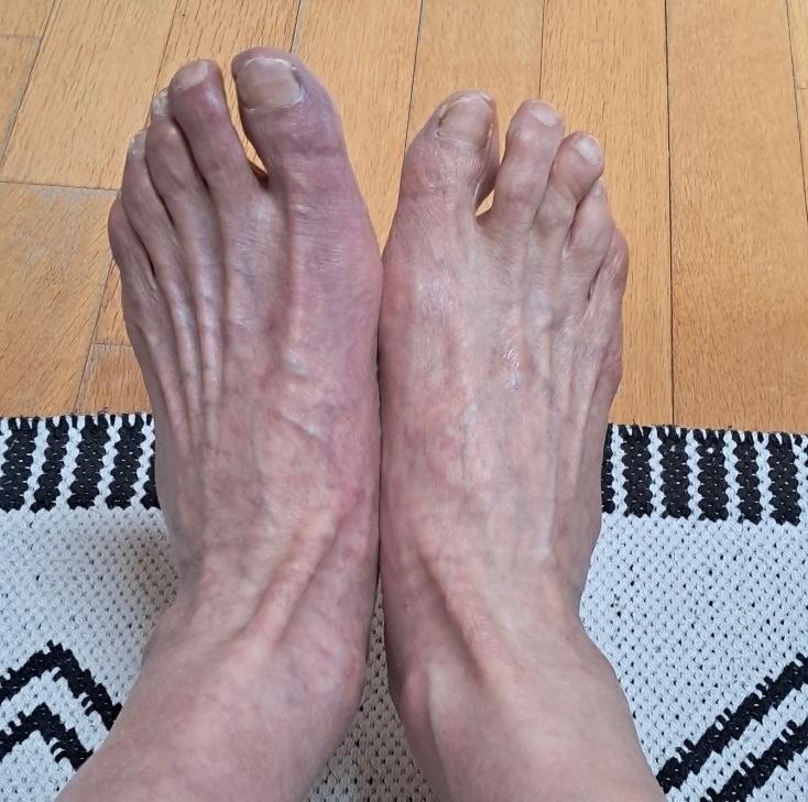 2번 째 사진