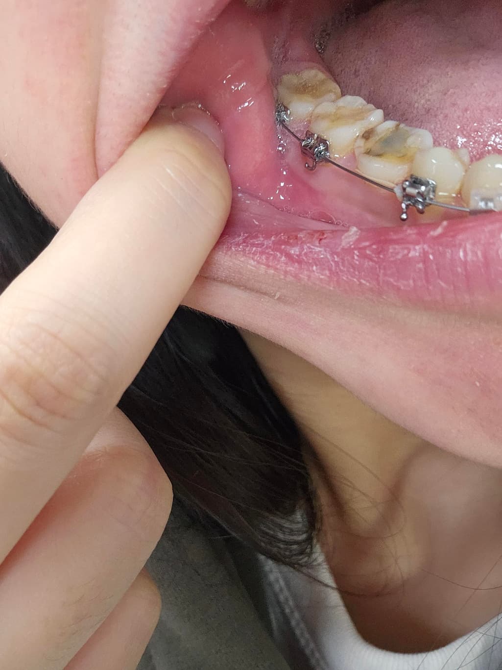 3번 째 사진