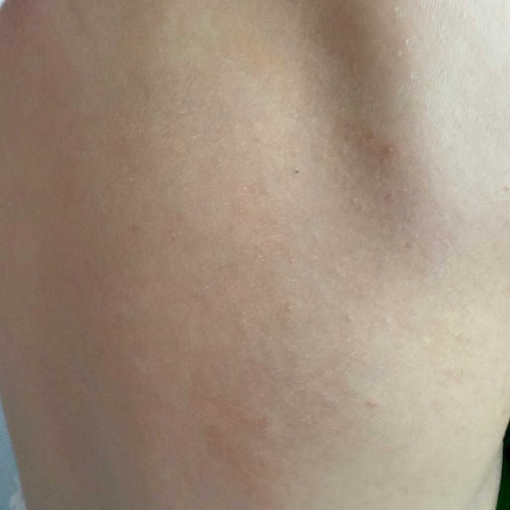 2번 째 사진