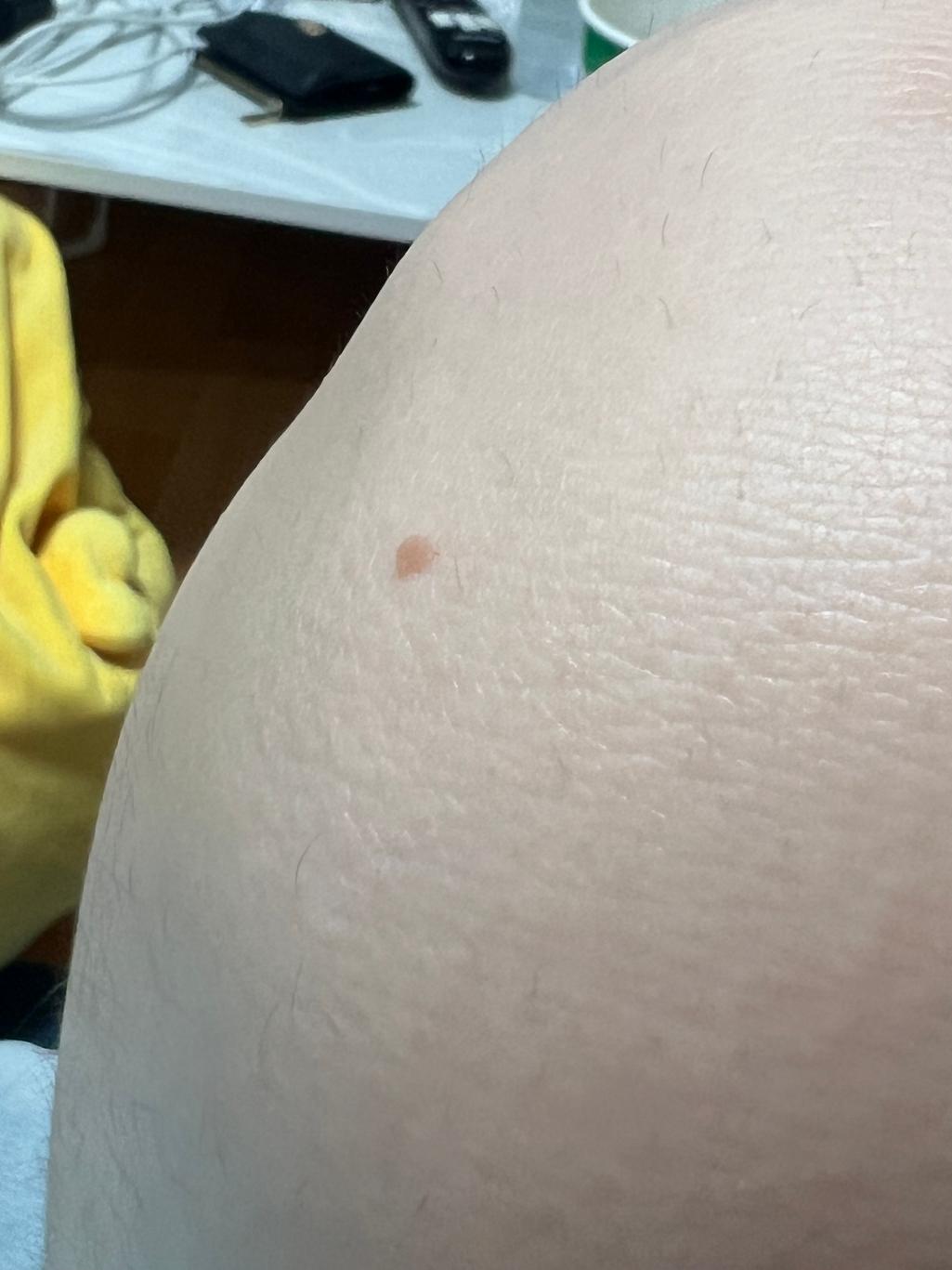3번 째 사진