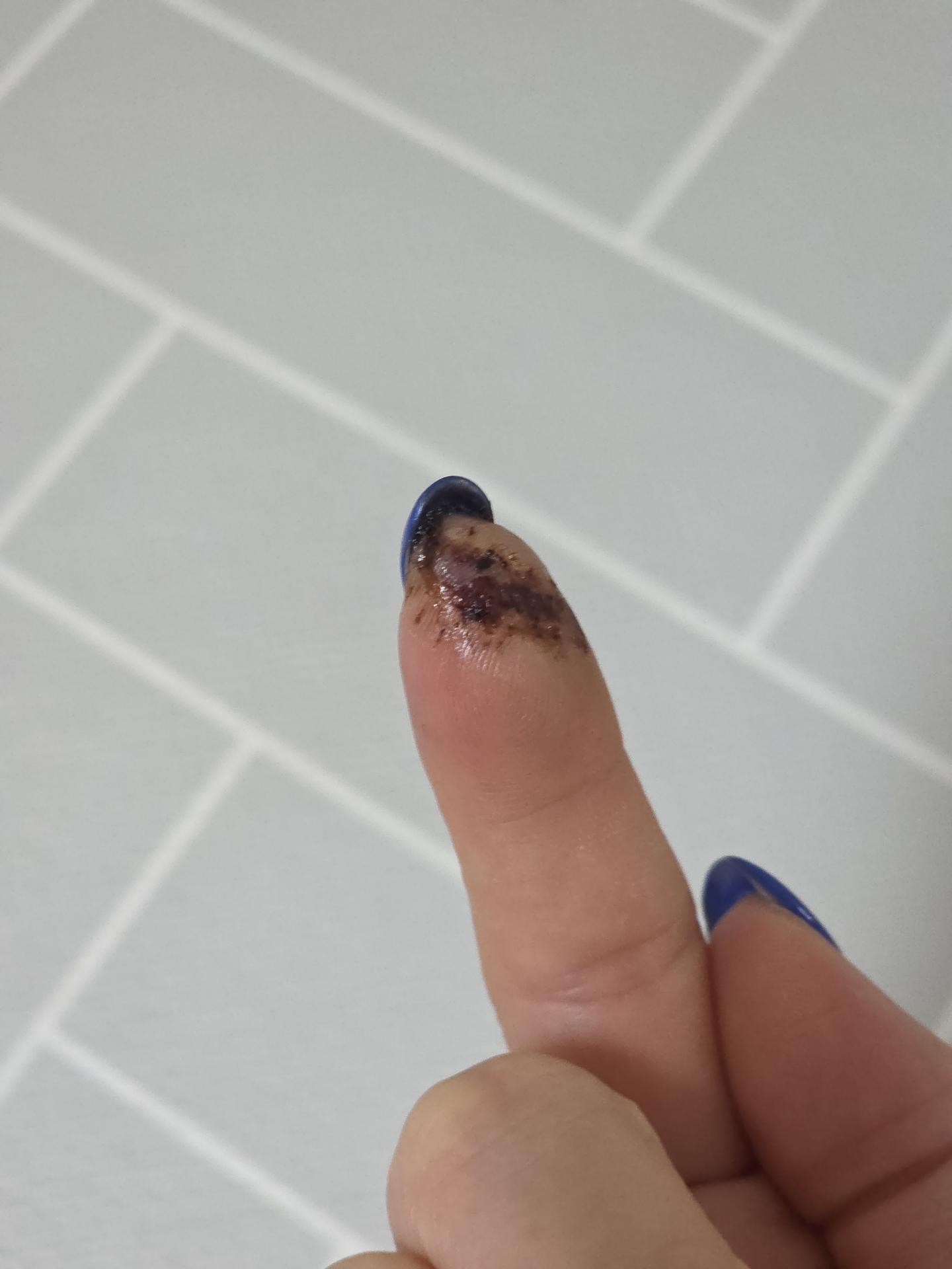 3번 째 사진