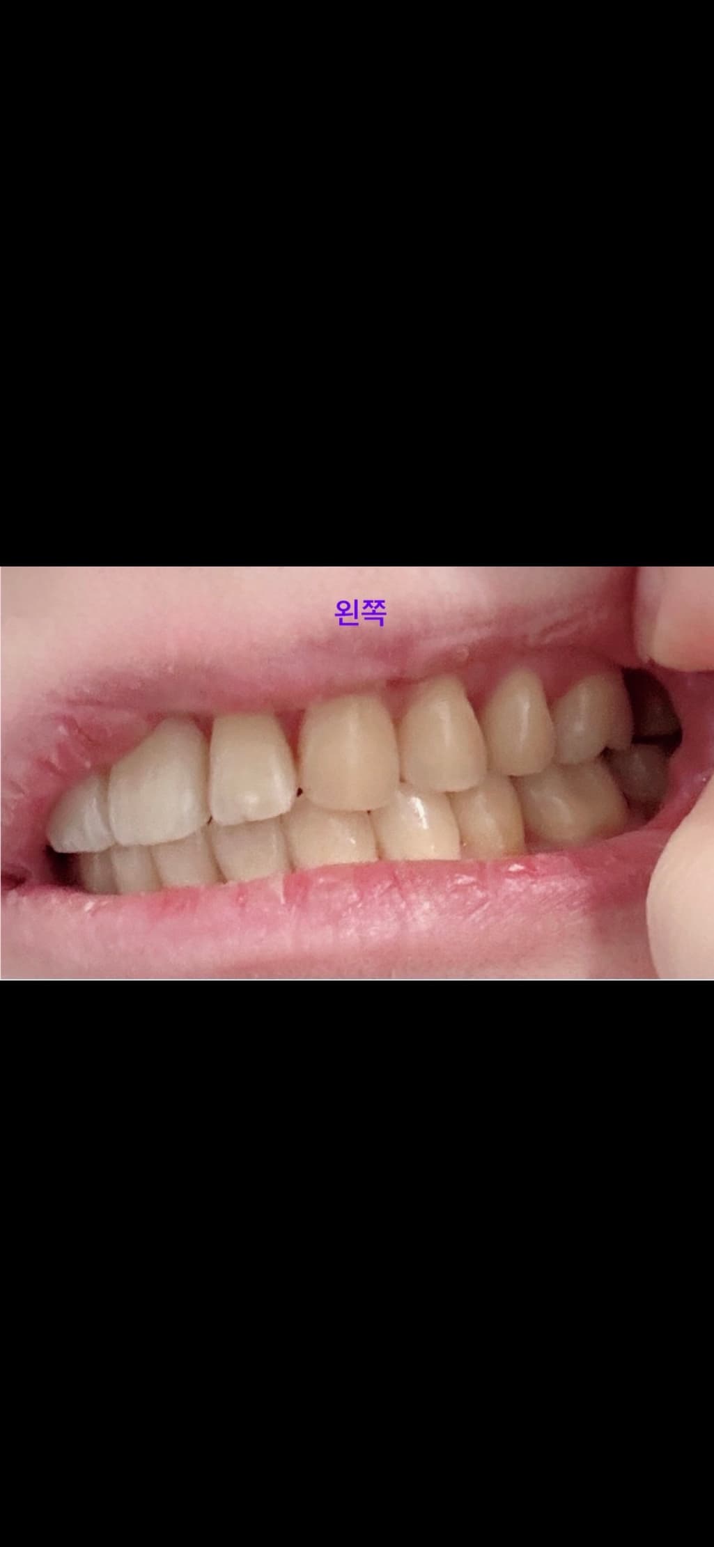 2번 째 사진