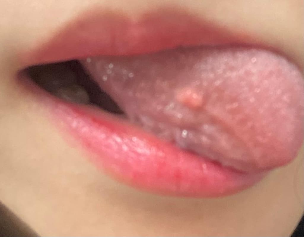 2번 째 사진