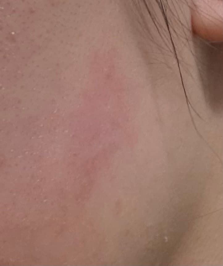 2번 째 사진