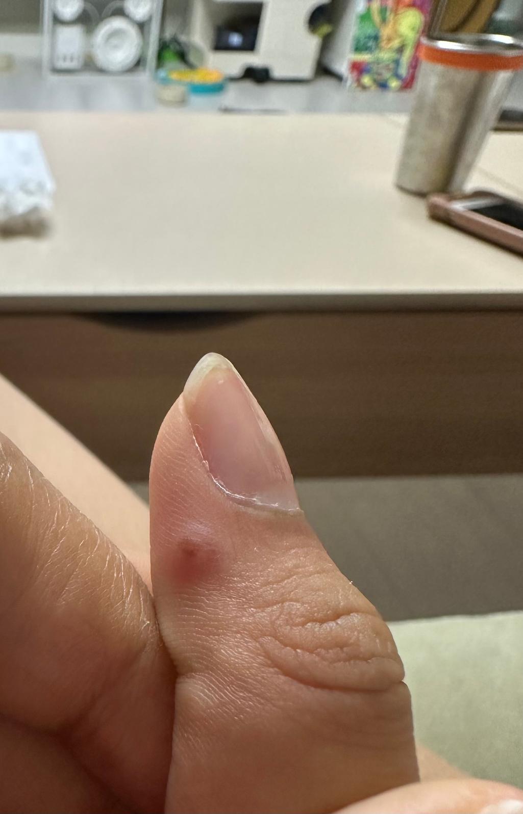 2번 째 사진
