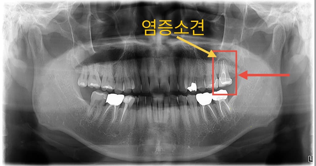 1번 째 사진