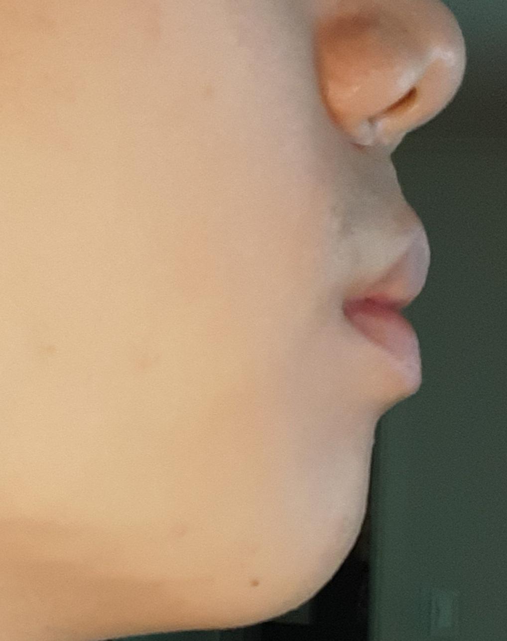 2번 째 사진