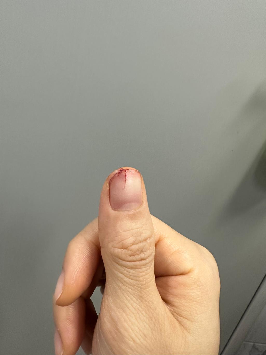 2번 째 사진