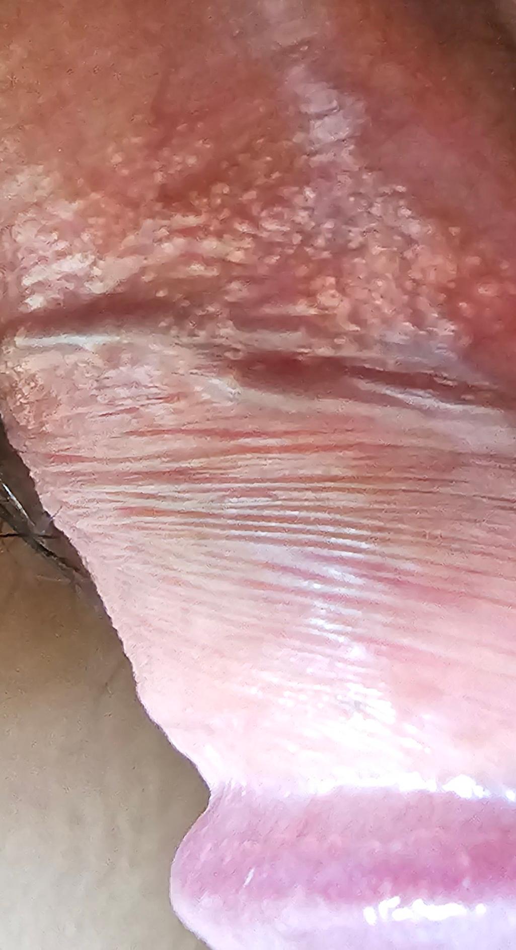 2번 째 사진