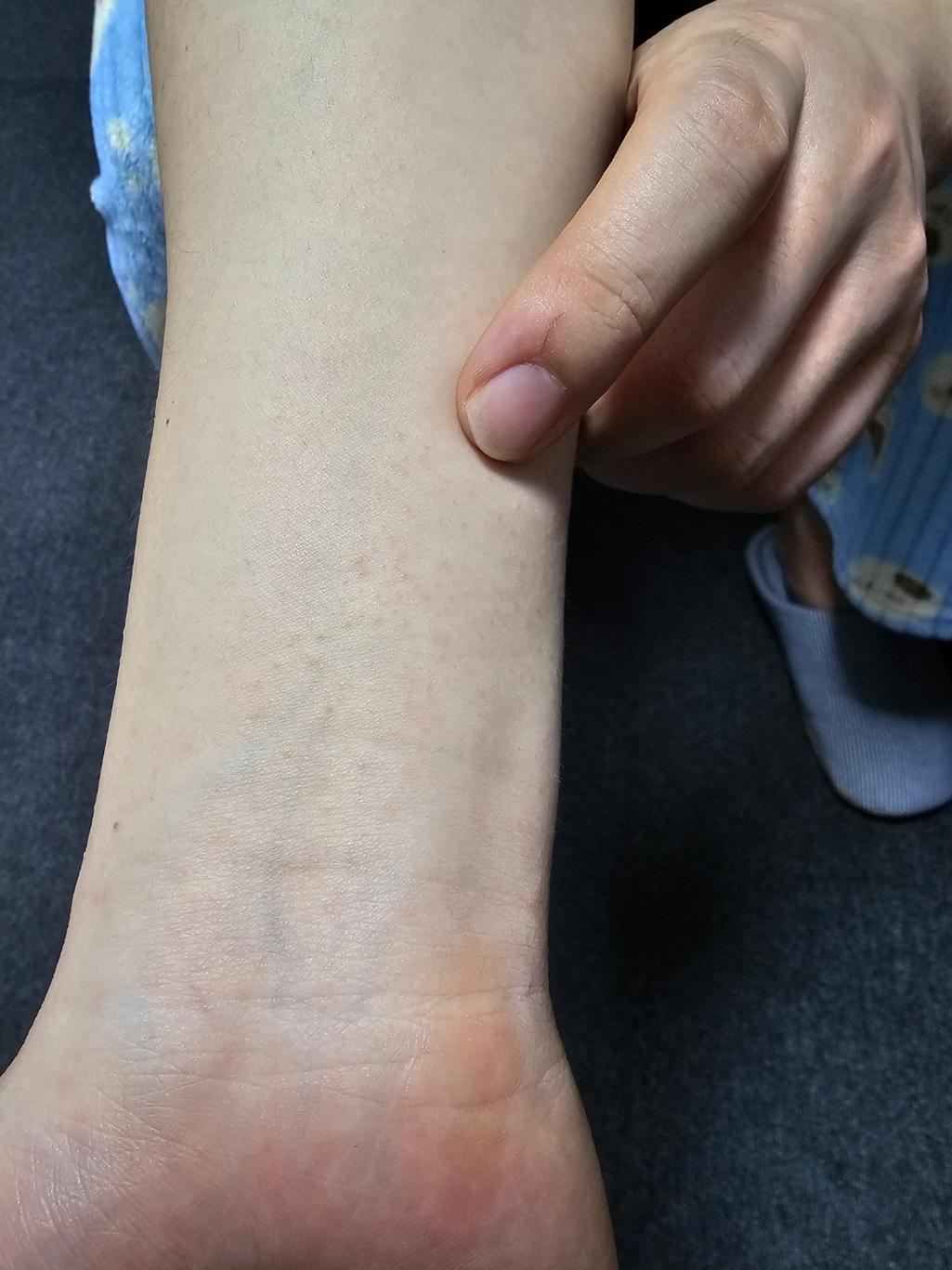 2번 째 사진