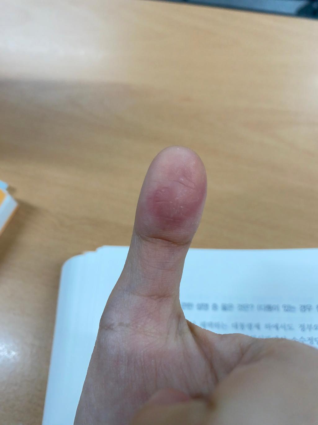 2번 째 사진