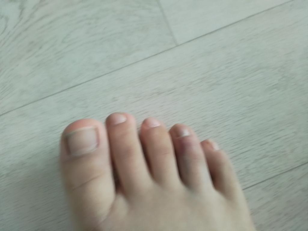 2번 째 사진
