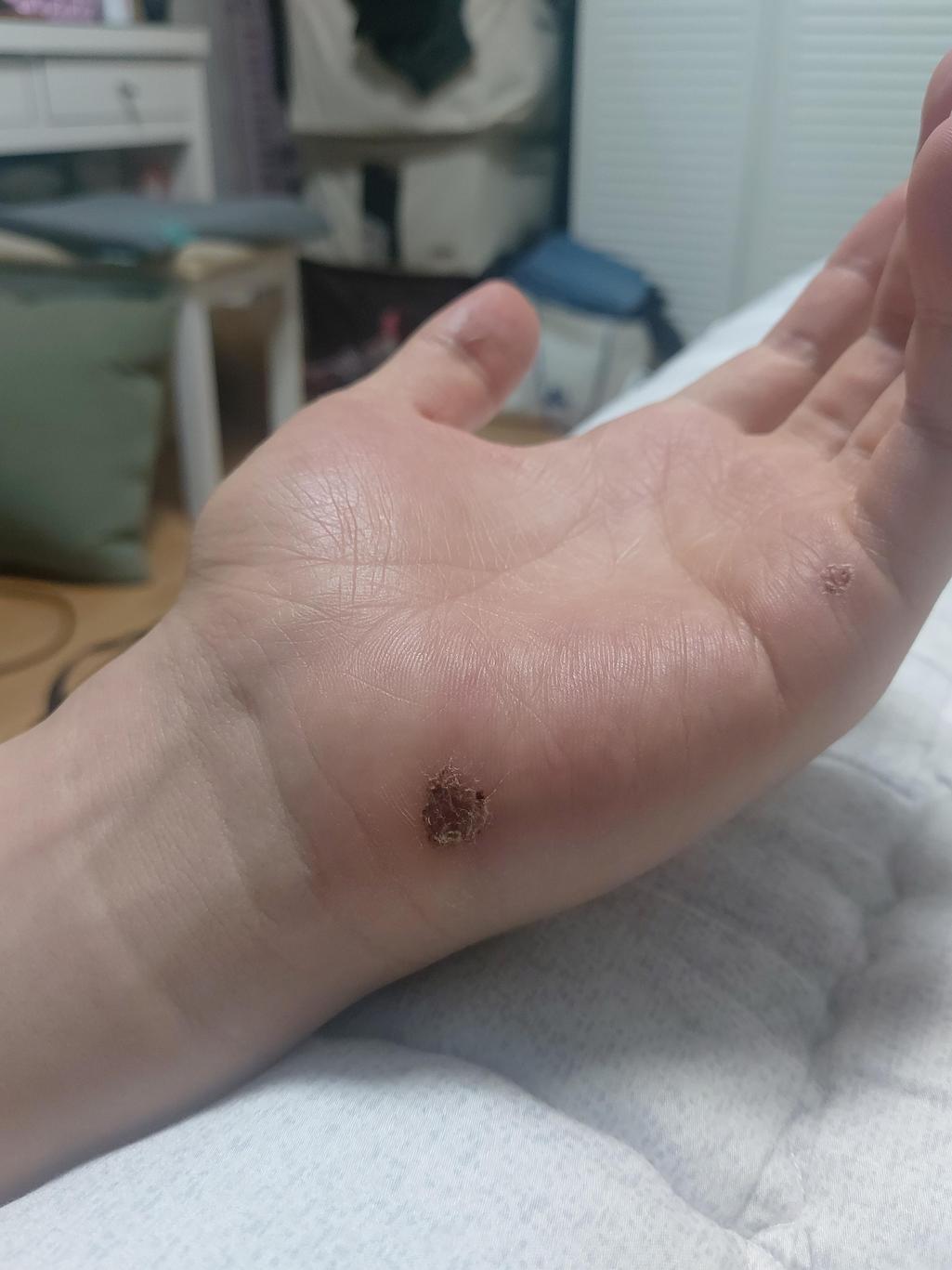 2번 째 사진
